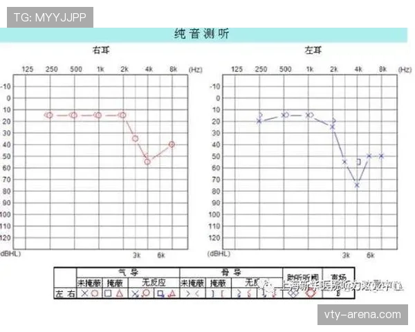 犯规判定要点:裁判依据接触程度与故意性判罚标准 犯规判定要点:裁判依据接触程度与故意性判罚标准